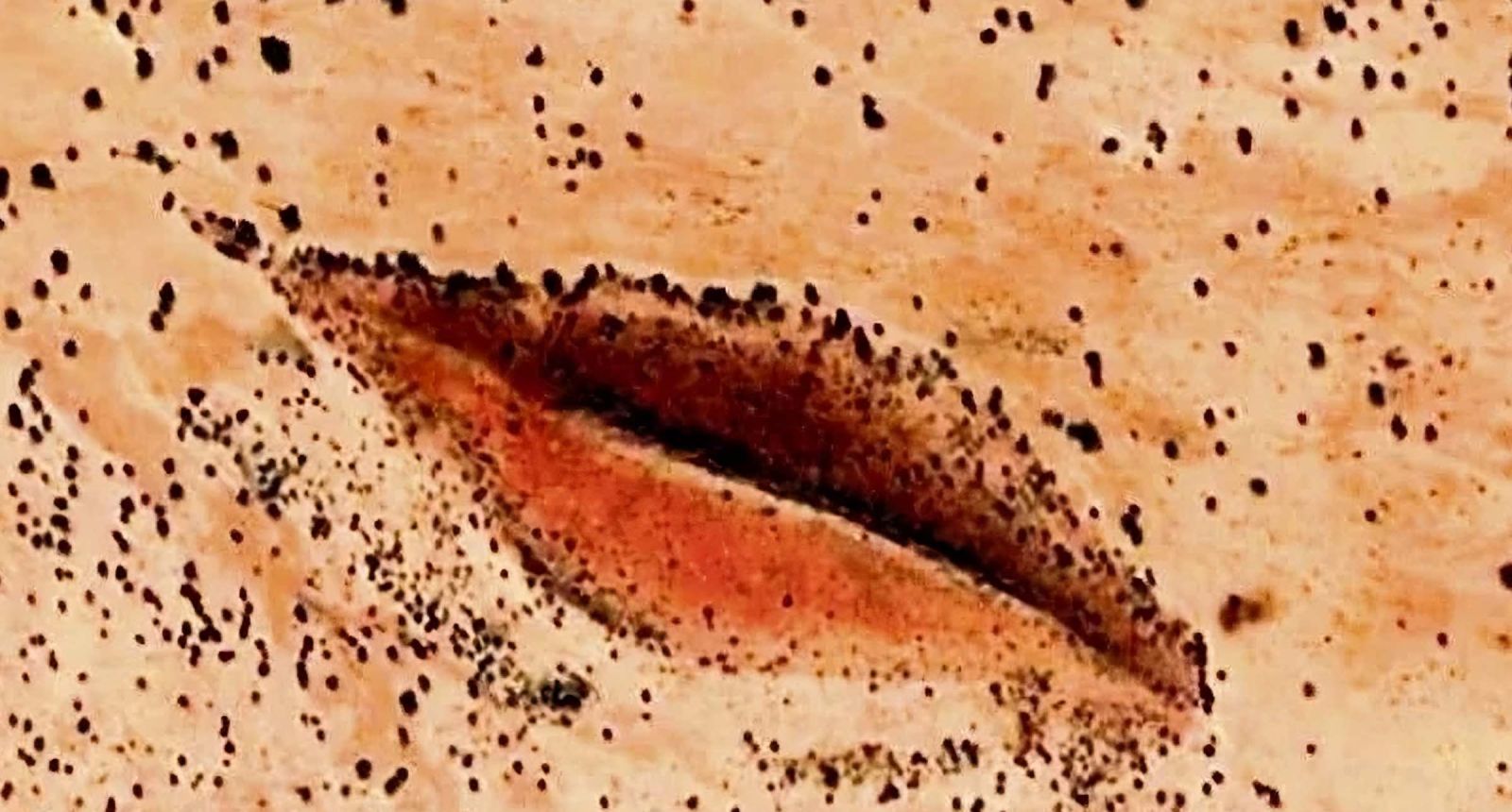 The Luscious Vaginal Lips of Darfur