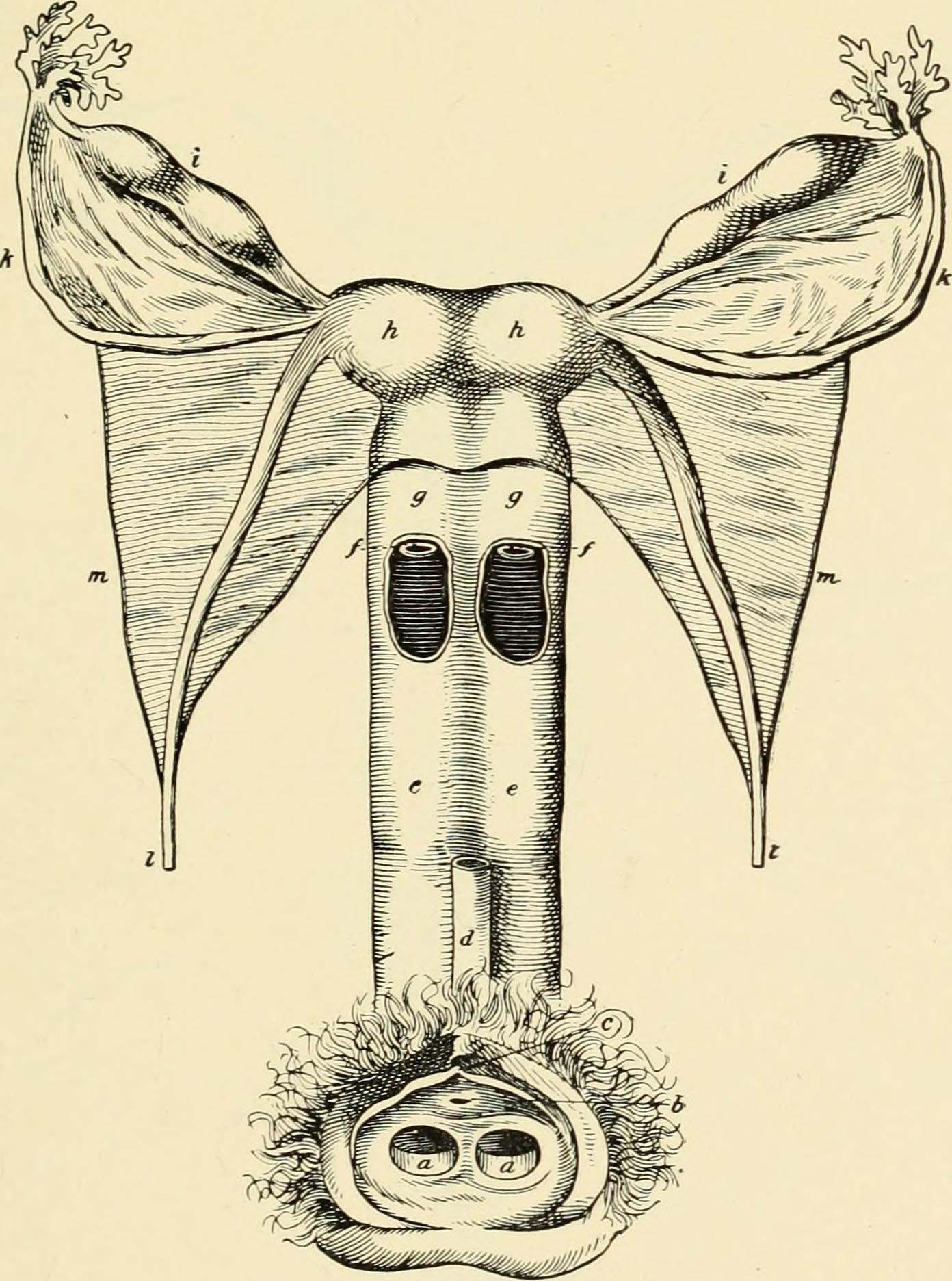 Image illustrates a Uterus Didelphys with two vaginas