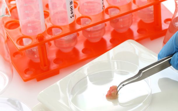 Lab-Grown Vaginas Cells