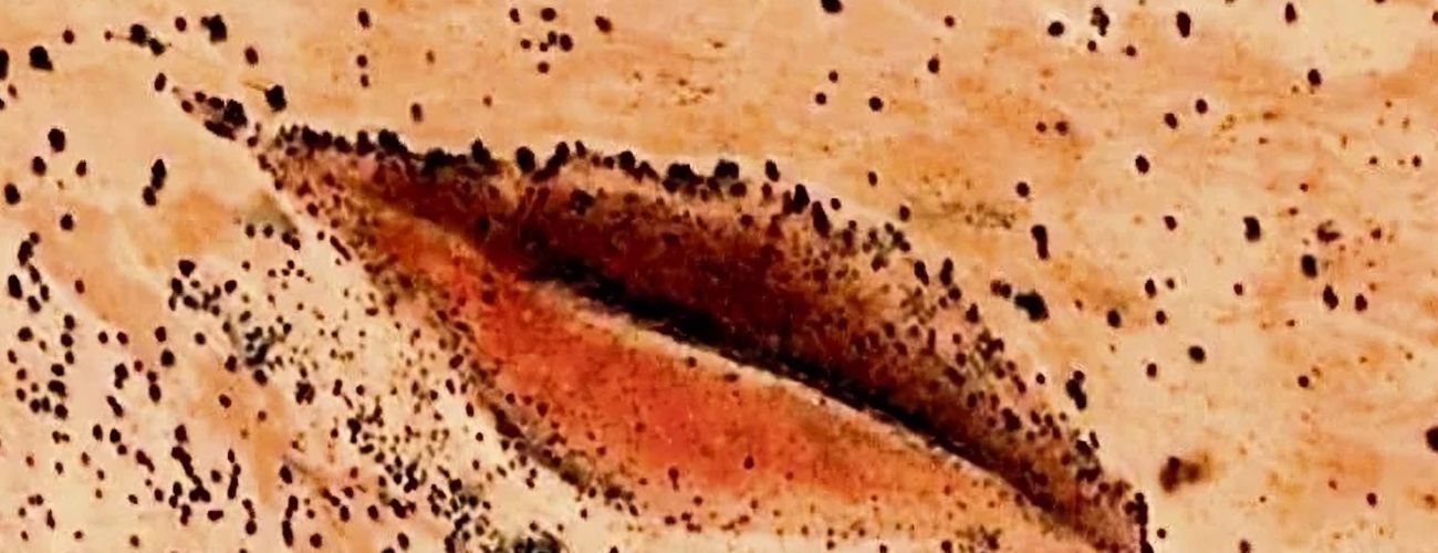 Los Labios Vaginales Lujosos de Darfur