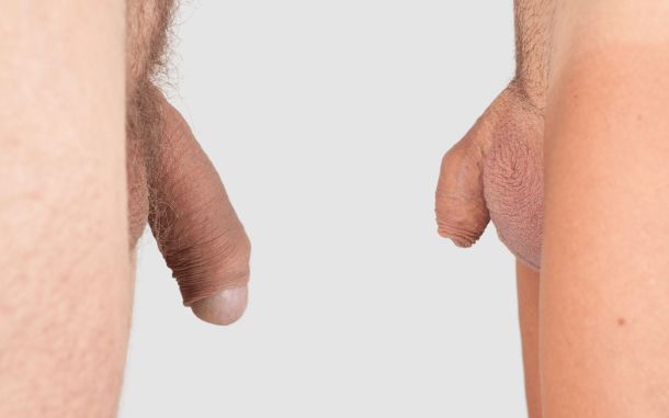 Is Your Penis a ‘Grower’ or a ‘Shower’