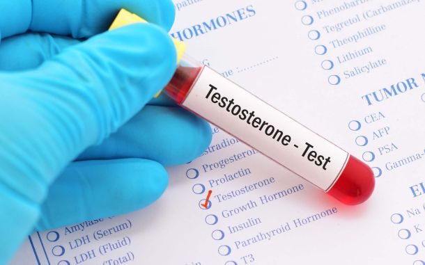 What causes high testosterone levels in women
